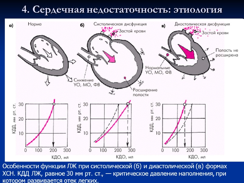 4. Сердечная недостаточность: этиология Особенности функции ЛЖ при систолической (б) и диастолической (в) формах